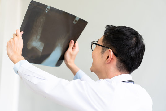 young doctor looking at film x-ray of foot. healthcare and medecal concept