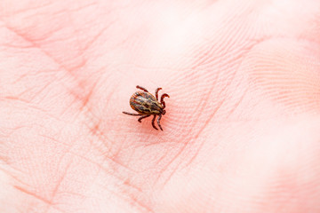 Infectious Encephalitis Tick Insect Crawling on Skin. Encephalitis Virus or Lyme Borreliosis Disease Infected Dermacentor Tick Arachnid Parasite Macro.