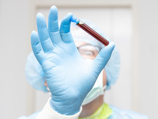The doctor hold test tube with a testing blood, focus on a hand, blurred face. Research blood of...