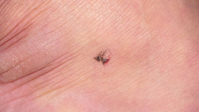Closeup scene of hand hit on female mosquito when sucking blood from human, bleed from messed insect corpse impress on man skin, annoy bug killed, fresh rupture dead body