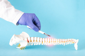 Doctor's hand with a scalpel near the mock up of the human spine on a blue background. Spine surgery concept, vertebroplasty, copy space for text, minimally invasive surgery - obrazy, fototapety, plakaty