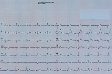 Herzuntersuchung mit EKG