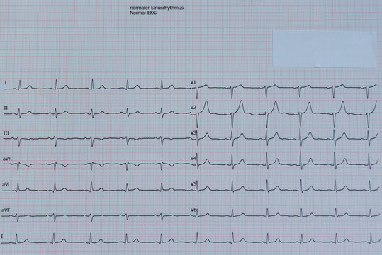 Herzuntersuchung mit EKG