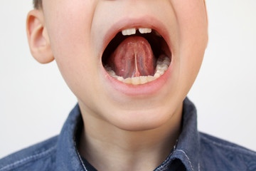 boy, kid opened his mouth, oral cavity, close-up teeth, performs articulation exercises for the...