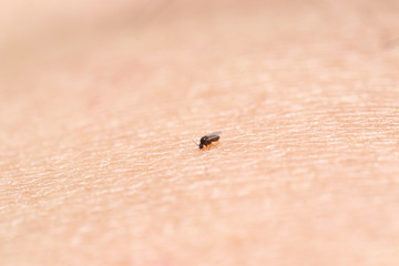 Black fly (gnat) sucking blood. Very small insect 1.5 mm. length compare to human skin surface