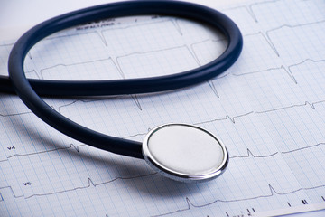 Cardiogram with stethoscope on table, closeup