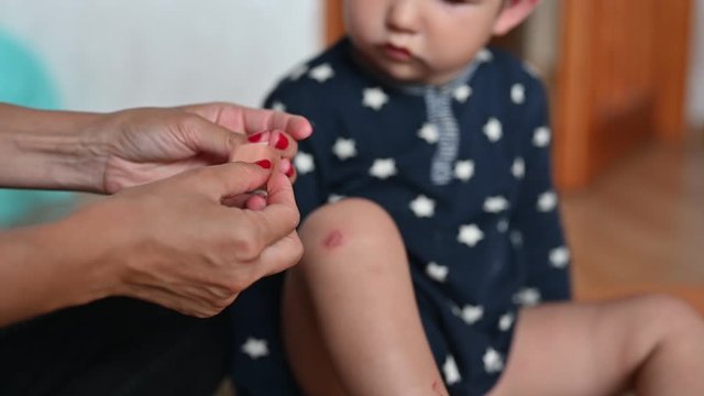 The mother heals the wound on the child's leg. mother's care for the child