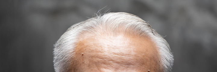 Asian senior man with white hair, old age baldness, hair loss problem