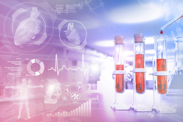 Fototapeta premium Medical 3D illustration, test-tubes vials in study facility - blood analysis for red cell distribution or hiv with creative gradient overlay