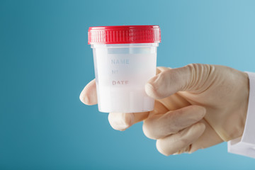 A doctor's gloved hand holding a bottle of a container with a sperm sample for medical analysis.