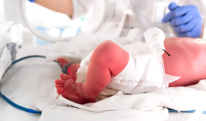 Fototapeta premium Nurse in blue gloves takes action to monitor and care for premature baby, selective focus. Newborn is placed in the incubator. Neonatal intensive care unit