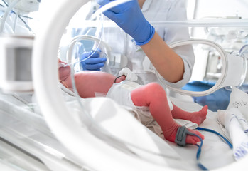 Photo of a premature baby in incubator. Focus is on his feet. Nurse in blue gloves is using the feeding tube for feeding premature baby. Neonatal intensive care unit