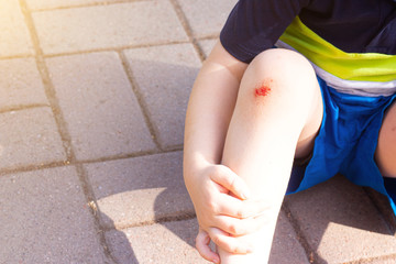 The wound on the child's leg . Fell on the road. Broken knee. Health. Article about the fall of a...