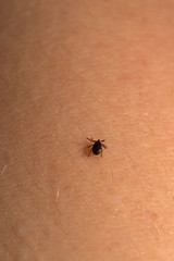 Tick Acari mite on human skin. Dangerous insects.