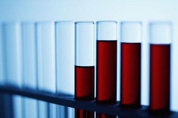 Test tubes with liquid on rack