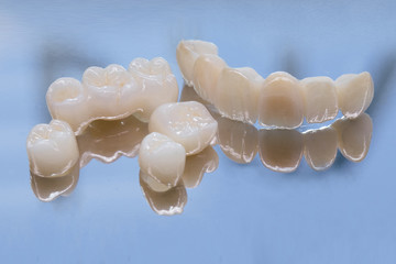 Metal Free Ceramic Dental Crowns. Ceramic zirconium in final version. Staining and glazing....