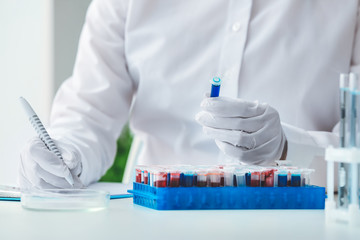 Scientist working with blood samples in laboratory