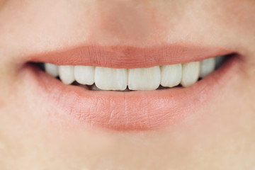 Ceramic crowns of human teeth closeup macro. The concept aesthetic dentistry.