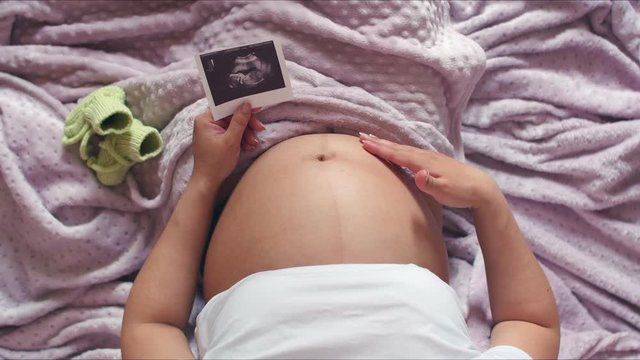A pregnant woman is lying in bed with a blanket covering her legs, top view. A woman strokes her stomach with her hand, and in the second holds the first photo of the child with an ultrasound