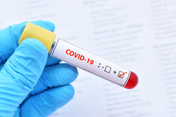 Blood sample tube positive with COVID-19 virus or novel coronavirus pandemic disease in 2020