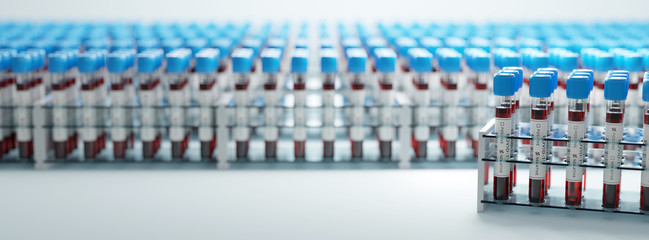Fototapeta premium Coronavirus Covid19 test tubes in a rack. Medical screening and Covid tests production