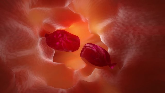 3D Animation of a gastrointestinal polyp during Entersocopy.