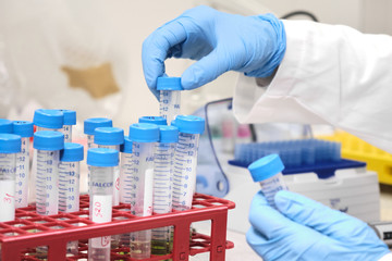 Sample preparation process by analytical chemist. Close up womans hand taking falcone tube and...