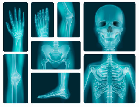 Human Bones skeleton radiology X-rays Vector