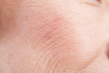 シニア女性の頬