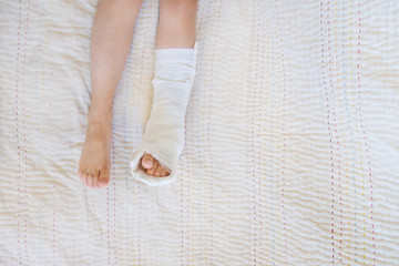 broken leg. Close-up of the cast on the feet. exercises to repair and strengthen muscles. damage to the bones. medical care of a surgeon in the emergency room