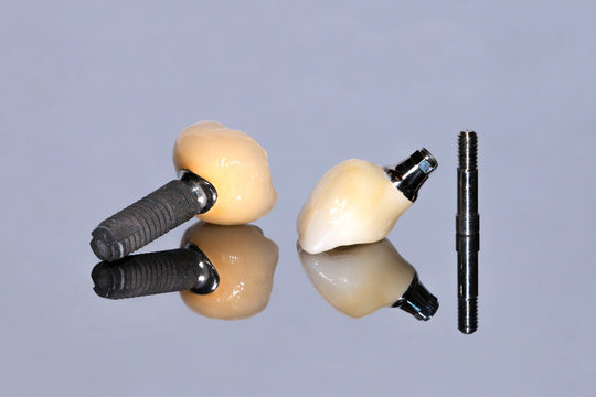 Metal-ceramic crowns on the implants. Screw-retained ceramic crown. Implant screw. Close up on gray.
