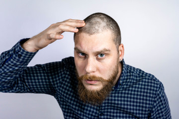 Man with alopecia on head, touching hair and looks in the mirror. Spot Baldness, Hair fall problem