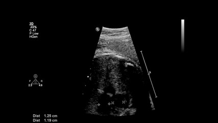 Fototapeta na wymiar Ultrasound screen with fetal echocardiography.