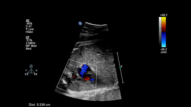 Ultrasound Screen With Fetal Echocardiography.