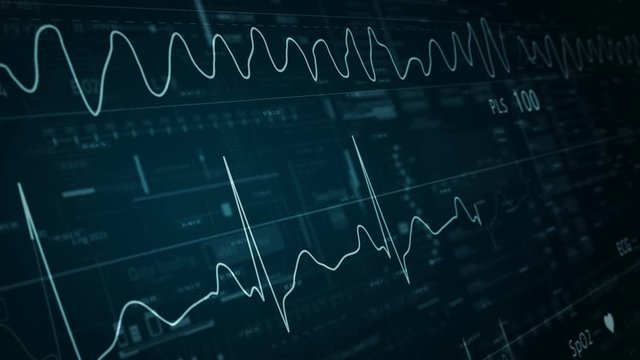 ECG abstract HUD.Heart beat line template.Cardiogram monitor.Technological HUD for medicine and science,Medical Institute students.Vfib.