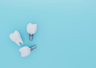 Tooth Crown and Tooth Implants on blue background with copy space, dental implantation, artificial teeth, 3d render