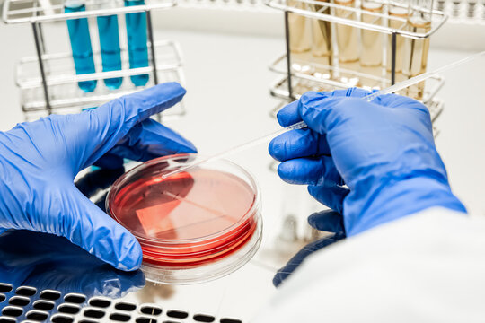 Researcher working with petri plate in a microbiology laboratory. In the background are test tubes with multi-colored liquids
