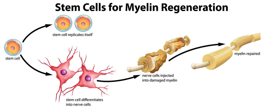 Stem cell for myelin regeneration