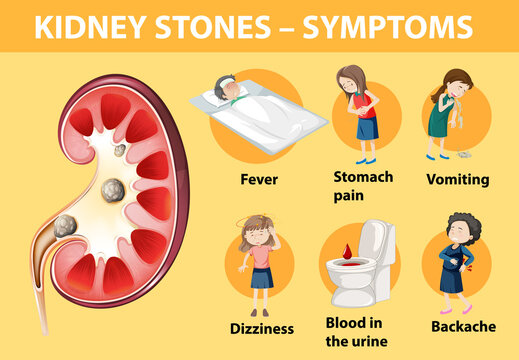 Kidney Stone Cartoon Images – Browse 707 Stock Photos, Vectors, and Video |  Adobe Stock