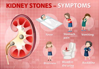 Obraz premium Kidney stones symptoms cartoon style infographic