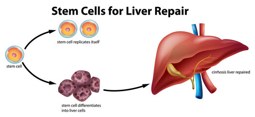 Stem cells for liver repair