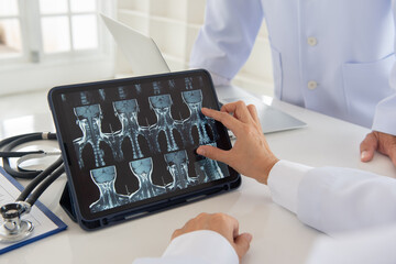 cervical spine x-ray image