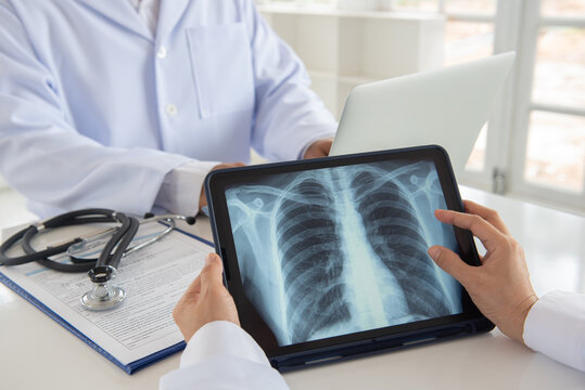 lung x-ray image on digital tablet