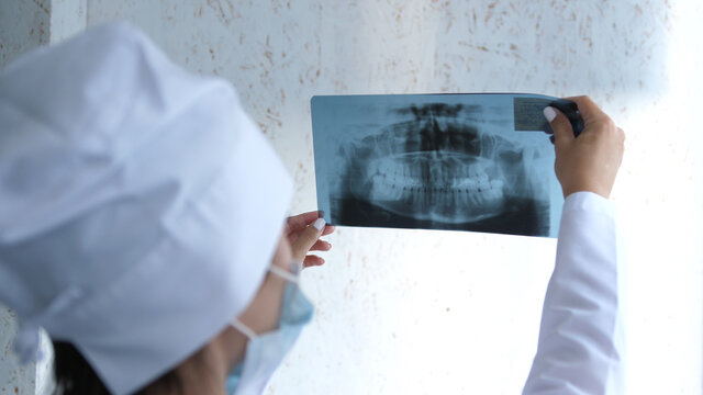 Closeup of dentist looking at dental x-ray plate.