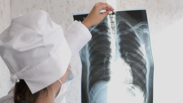 X-ray of the lungs in the hands of the doctor,the attending physician points his finger at the X-ray of the lungs to study the disease.Close-up. slow motion