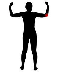 Fototapeta premium Rückansicht Frau mit Symbol für Ellbogenschmerzen