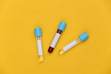 Blood test. Test tubes on yellow background. Top view