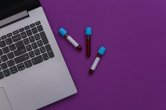 Workspace Of Doctor (laboratory Worker). Notebook, Test Tubes With Blood On Purple Background. Top View. Flat Lay