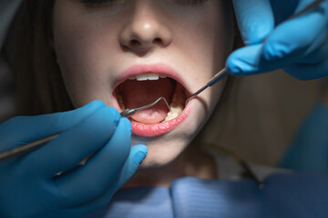 close-up of an open female mouth in bright light in a dark dentist office.