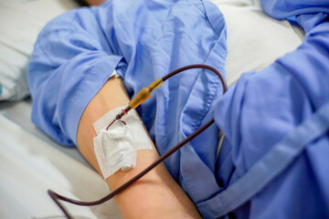 Healthcare medical patient close up blood transfusion on arm laying hospital clinical bed unhealthy illness disease infection treating people surviving pandemic coronavirus covid-19 quarantine